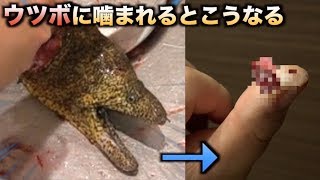 ウツボに噛まれるとこんな感じに指がエグれます