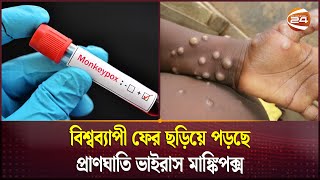 মাঙ্কিপক্স আতঙ্কে জরুরি অবস্থার ঘোষণা বিশ্ব স্বাস্থ্য সংস্থার | Monkey Pox Virus | Channel 24