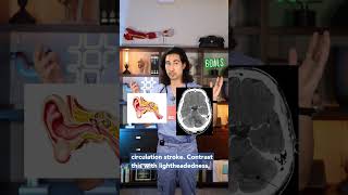 Feeling Dizzy? Doctor Explains #vertigo #dizzy #health