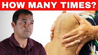 How many times is it possible to have a knee joint replacement?