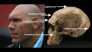 6 Neanderthal DNA physical traits in modern humans