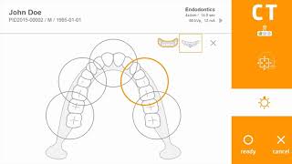 CT Acquisition tutorial on RAYCAN Alpha Plus