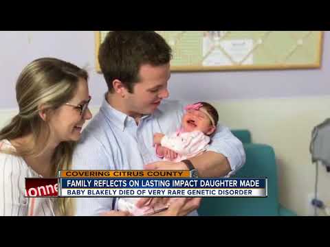 Do children with Pfeiffer syndrome live long?