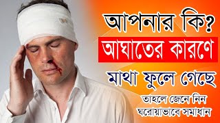 আপনার মাথায় কি আঘাত পেয়ে মাথা ফুলে গেছে? তাহলে জেনে কিভাবে বাড়িতে বসে প্রাথমিক চিকিৎসা করবেন খু সহজে