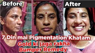 7 Din main Pigmentation Khatam | Bumper Remedy ka ek aur chamatkar