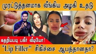 முரட்டுத்தனமாக வீங்கிய அழகியின் உதடு | கதறியபடி வீடியோ வெளியீடு! | Lip Filler treatment is Safe? |