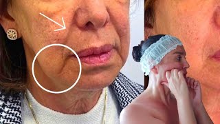 Lifting and Contouring Deep Face Massage | Myofascial Facial Massage as an alternative to injections