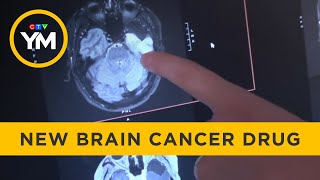 Revolutionary Brain Cancer Medication Approved in Canada | Your Morning