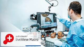 Discover PathoZoom® liveView Macro