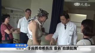 僵直性脊椎炎所苦 老是垂頭喪氣