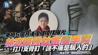 車禍5個月後復健模樣曝光！林志穎秀鈦金屬手臂　打11支骨釘「説不痛是騙人的」｜鏡週刊