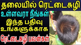 தலையில் ரெட்டைசுழி உள்ளவர்கள் மட்டும் பார்க்கவும் | Sattaimuni Nathar