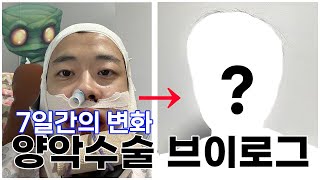 [Vlog] 언럭키 아무무 | 양악수술브이로그 | 안면비대칭