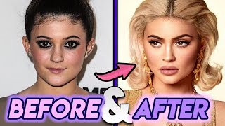 Kylie Jenner | Before & After Transformations | Plastic Surgery UPDATED