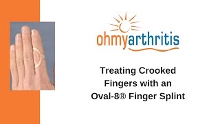 How to Treat a Crooked Finger with an Oval-8 Finger Splint - Oh My Arthritis