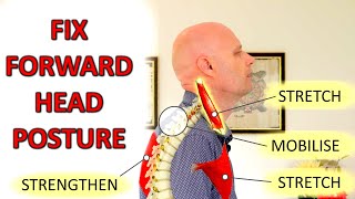 How To Fix Forward Head Posture & Neck Pain