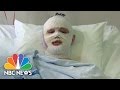 American Teen Recounts Surviving His Second Terror Attack In Brussels | NBC News