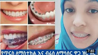 ጥርሳቹን ብሬስ ማሳሰር የምፈልጉ  በቅናሽ ዋጋ ሙሉ መረጃ