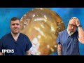 EAR WAX REMOVED AFTER 4TH ATTEMPT - EP1015