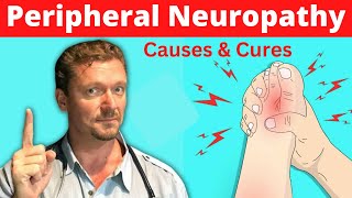 Peripheral NEUROPATHY (Causes and Cures) 2022