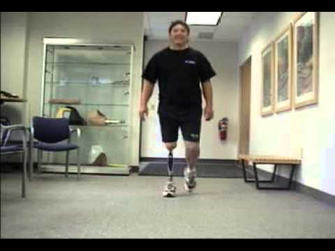 Otto Bock 3R60 Prosthetic Knee Training 4 - YouTube