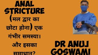 anal stricture (मलद्वार का छोटा होना) एक गंभीर समस्या।इसका समाधान?