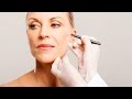 What If Face-Lift Is Too Tight? | Plastic Surgery