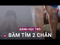 Cô giáo dùng thước đánh học trò bầm tím hai chân ở Quảng Nam vì học sinh đánh nhau | VTC Now