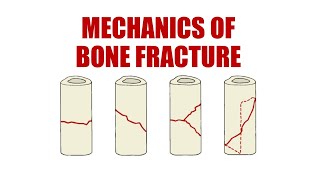 Skills Lab : Mechanics of Bone Fracture