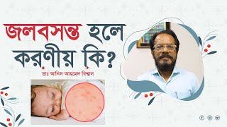 জলবসন্ত থেকে মুক্তির উপায় কি? What is the way to get rid of chicken pox?