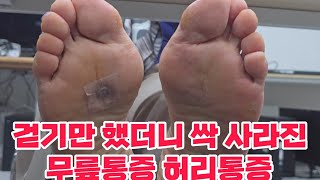 걷기만 했더니 싹 사라진 무릎통증 종아리 허벅지 통증 발바닥까지 시리고 저리고 땡기던 허벅지 종아리 통증 걷기만 했더니 싹 사라졌어요