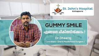 Gummy Smile എങ്ങനെ ചികിൽസിക്കാം  😬 | Oral \u0026 Maxillofacial Department |  @StJohnsHospitalKattapana