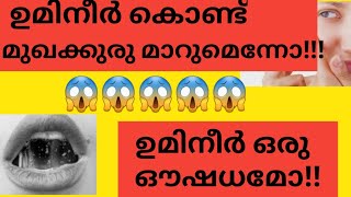 😱😱😱ഇതുവരെയിതറിന്നില്ലലോ ........ ന്റെ പടച്ചോനെ.......||saliva tips for acne||beauty zone||