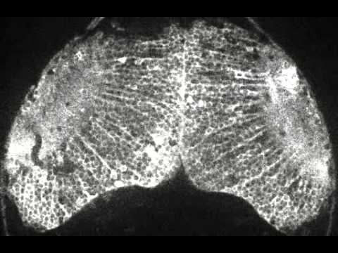 CUM SE FORMEAZA GANDURILE INTR-UN CREIER  (VIDEO)