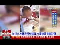 7歲女童遭犬咬撕裂傷 飼主：絕無推卸責任