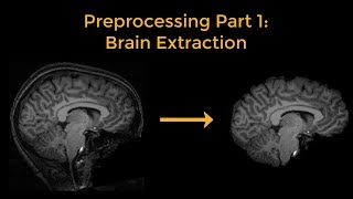 fMRI Short Course #4a: Preprocessing Part 1- Brain Extraction