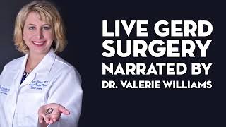 LINX Surgery featuring Dr. Valerie Williams