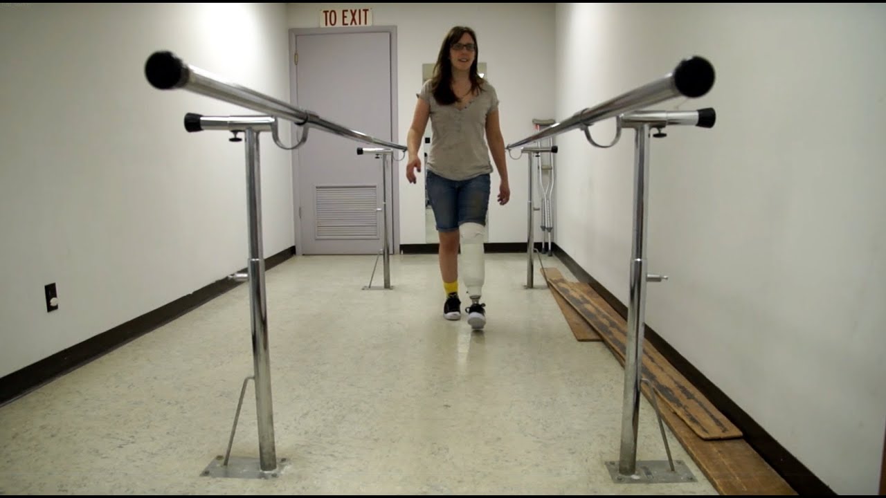 AmputeeOT: First Time Walking After My Below Knee Amputation With Check ...