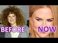 Women and Time: #Nicole #Kidman.  BEFORE and NOW