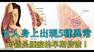 注意！女人身上出現5種異常，可能是「腫瘤」的早期信號！一定要小心，不然容易「癌變」！