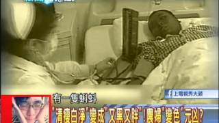 07/03新聞龍捲風part3　恐怖「變色人生」！　白淨農婦一覺醒來竟變「包公」！