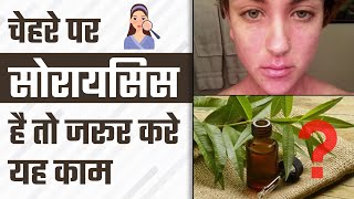 चेहरे पर सोरायसिस है तो जरूर करे यह काम | Face Psoriasis Trigger And Treatment | Dr. Health