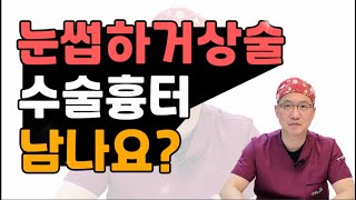 셀라성형외과★눈썹하거상술 수술흉터 남나요?  #눈썹하거상술 #하안검 #중년눈성형 #동안성형#눈썹앞흉터#신경손상#실제사례