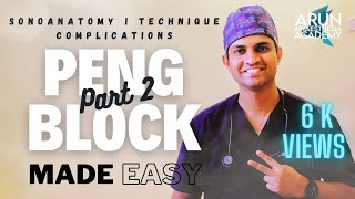 PENG BLOCK. PART 2. HIP ANALGESIA ANESTHESIA