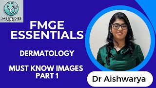 FMGE ESSENTIALS : MUST KNOW TOPICS DERMATOLOGY PART 1 #fmge #dermatology