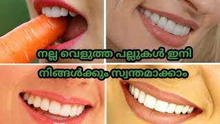 Teeth |Whitening |At |Home | Naturally| സുന്ദരമായ| പല്ലുകള്‍ക്ക്| തിളക്കമുള്ള | പല്ലുകള്‍ക്ക്