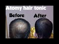 Atomy hair treatment amazing results