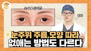 자글자글한 눈가주름 고민이라면 필독! 눈가주름 없애기