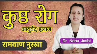 All Skin Disease - कुष्ठ रोगों का रामबाण नुस्खा | leprosy treatment, melasma, eczema - #skincare