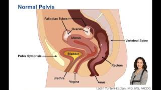 What is Uterine Prolapse, and How is it Treated?